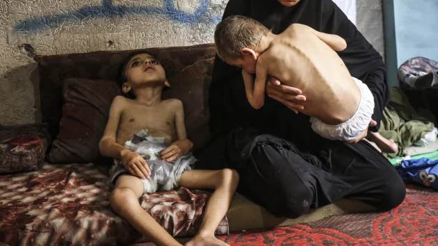 ‘I don’t know’: Trump says of Netanyahu denying Gaza starvation crisis