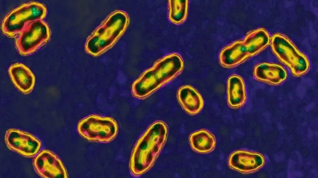 New Mexico man diagnosed with plague in state’s 1st human case this year: Officials