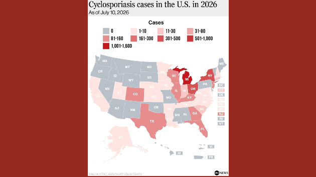 Here’s where cyclosporiasis is spreading as cases are confirmed in 32 states