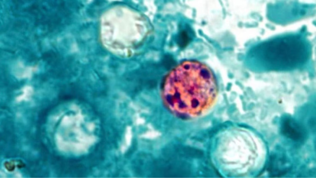 ‘Large and growing’ parasitic infection outbreak spreading in Michigan, health officials say