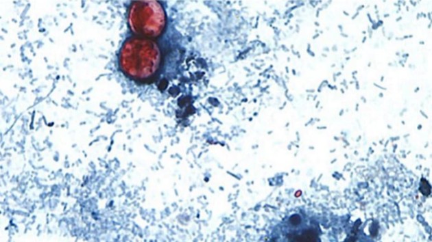 Cyclosporiasis cases in Michigan surpass 2,600, health officials say